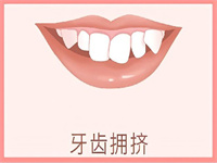 牙齿修复